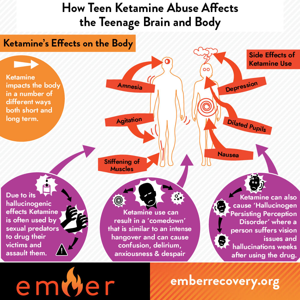 How Teen Ketamine Abuse Affects the Teenage Brain and Body